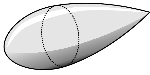 Zeppelin